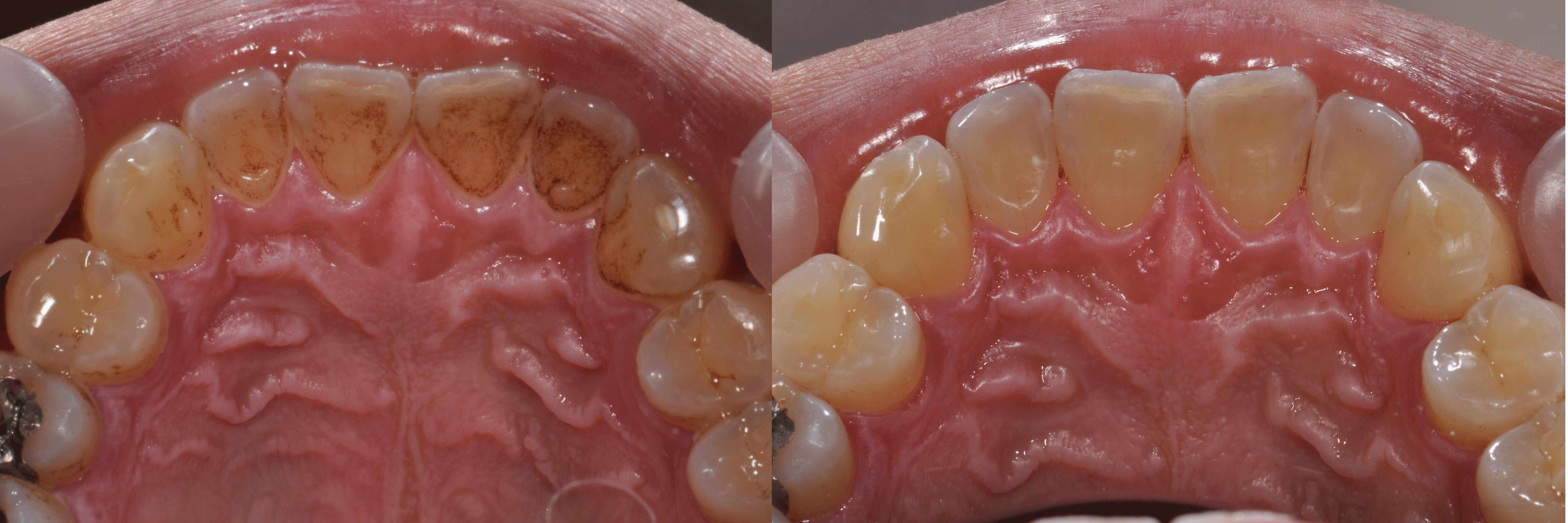 http://www.opera-dc.com/tooth3.jpeg
