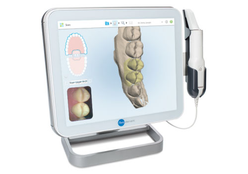 3Dでの治療計画