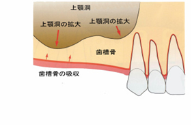 http://www.implant-map.jp/imp8/s-02.jpg