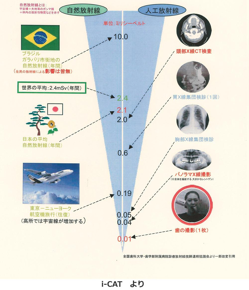 CTやレントゲンの被曝について